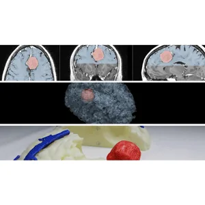 Udemy – Medical Imaging, 3D Modelling and 3D Printing – Beginners 2021-10